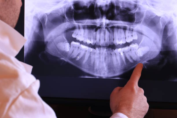 Best Urgent Dental Care in Gervais, OR