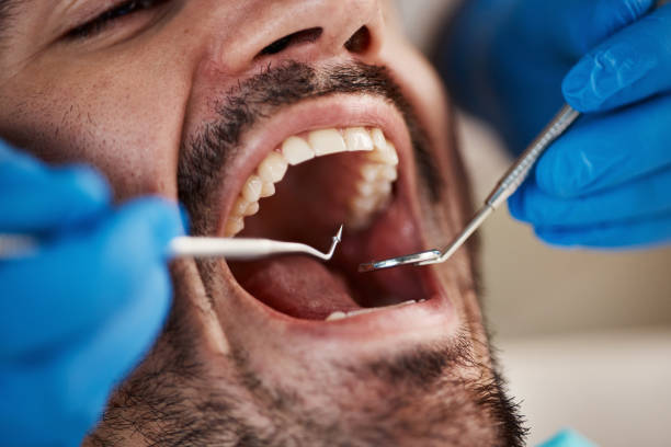 Best Emergency Broken Tooth Repair in Gervais, OR